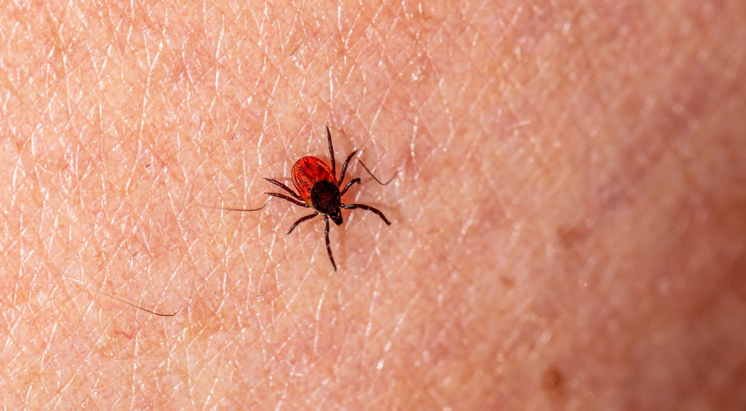 Lyme Disease and fatigue